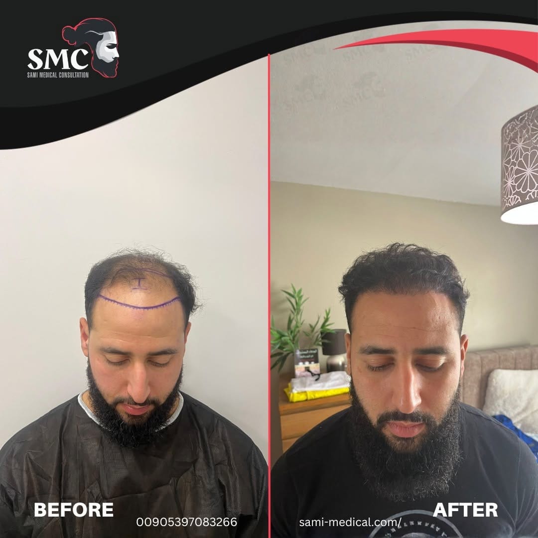 Post 3 by SAMİ MEDICAL CONSULTATIONS on Instagram (image)