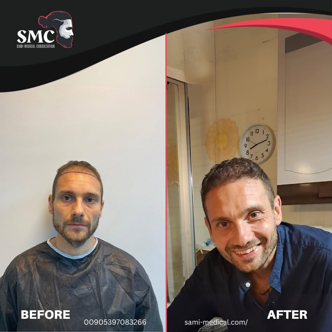 Post 9 by SAMİ MEDICAL CONSULTATIONS on Instagram (image)