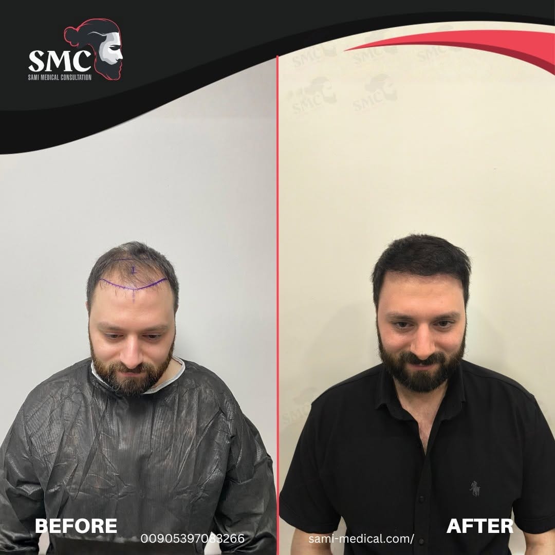 Post 6 by SAMİ MEDICAL CONSULTATIONS on Instagram (image)