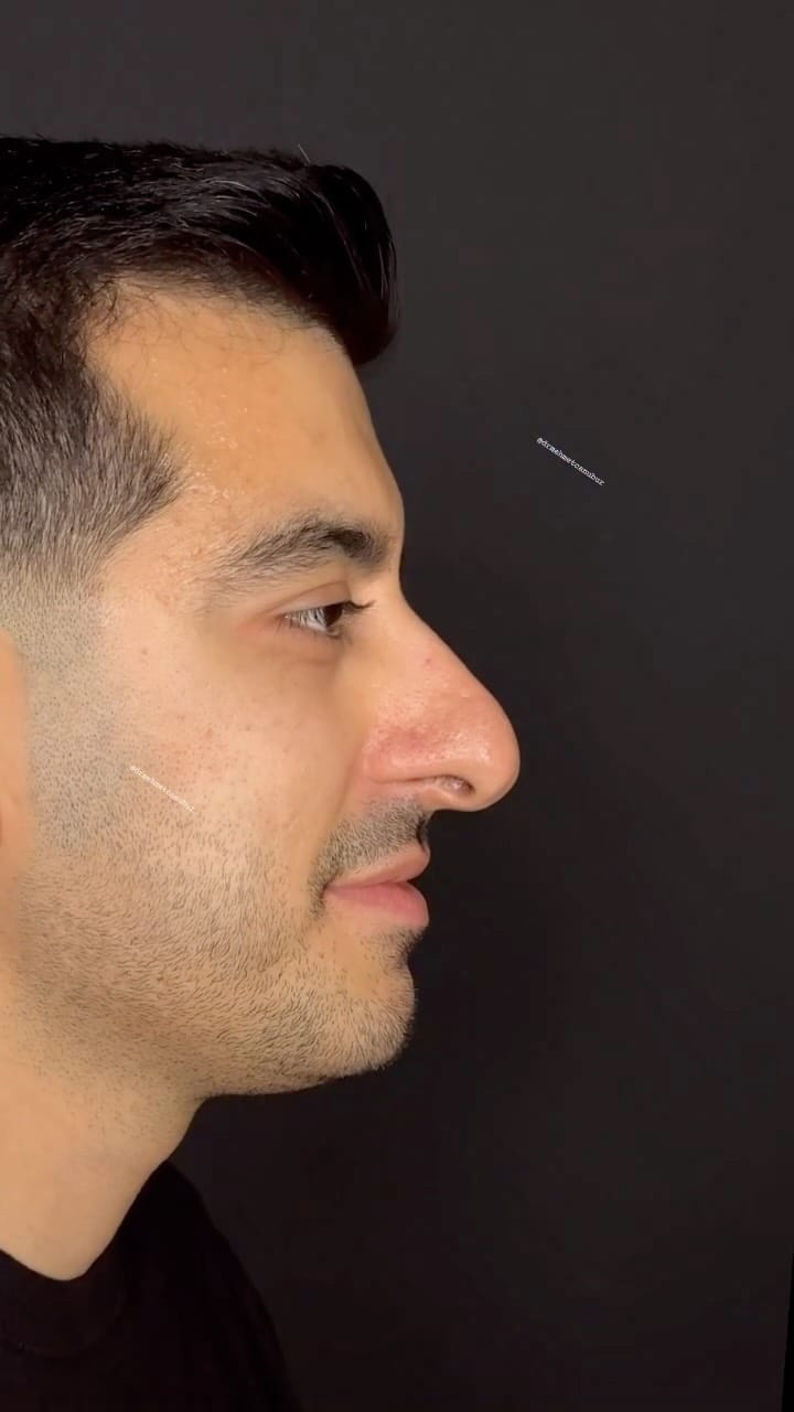 Post 3 by Mehmet Can Ubur on Instagram (video)