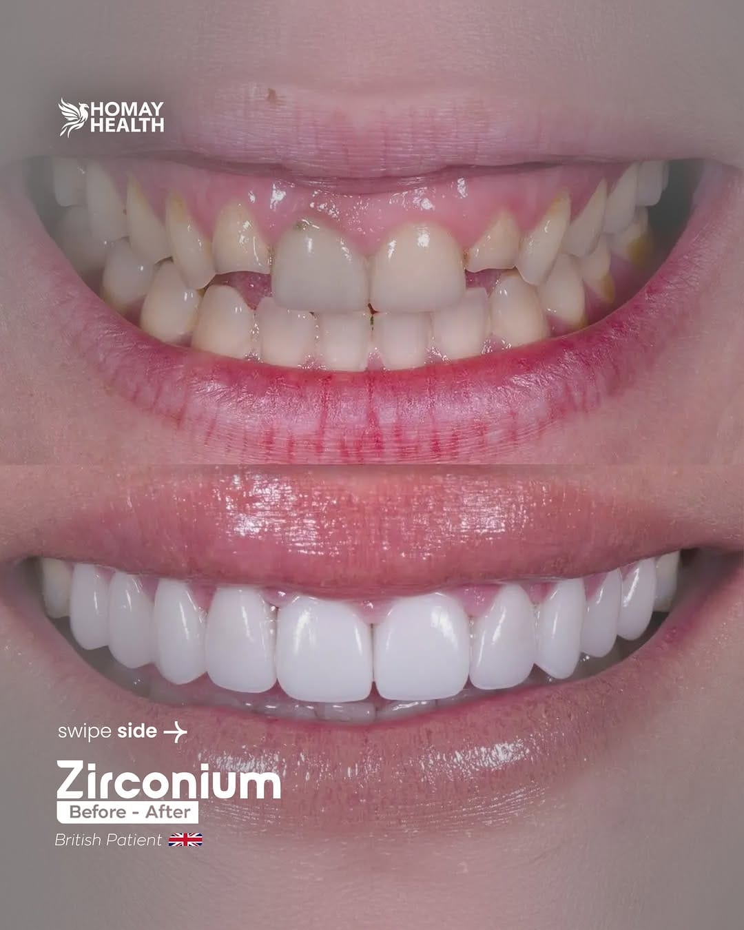 Post 4 by Homay dental on Instagram (carousel)