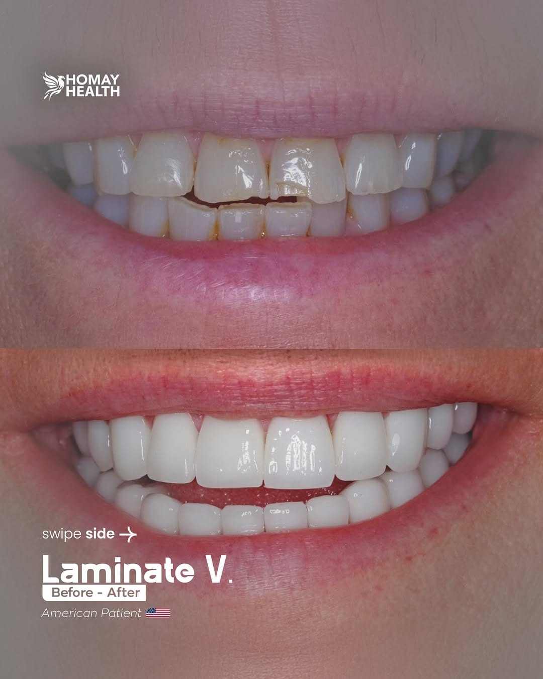 Post 8 by Homay dental on Instagram (carousel)