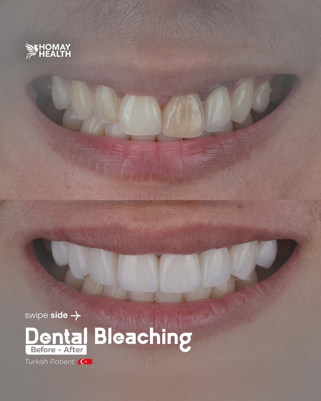 Post 1 by Homay dental on Instagram (carousel)