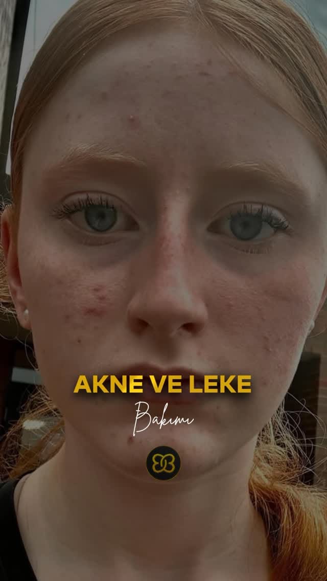 Post 3 by Beauty Boss Kadıköy 🦋 on Instagram (video)