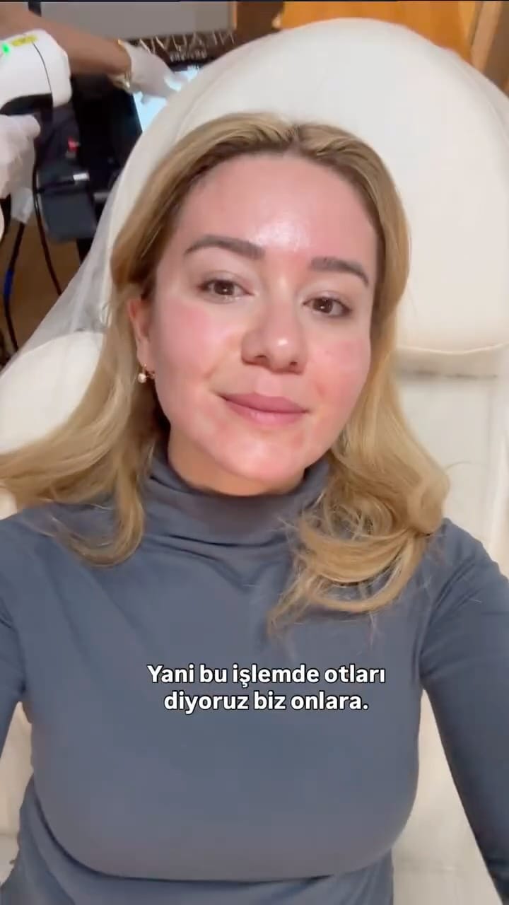 Post 9 by Uzm.Dr.Ayse Özkan Acar on Instagram (video)