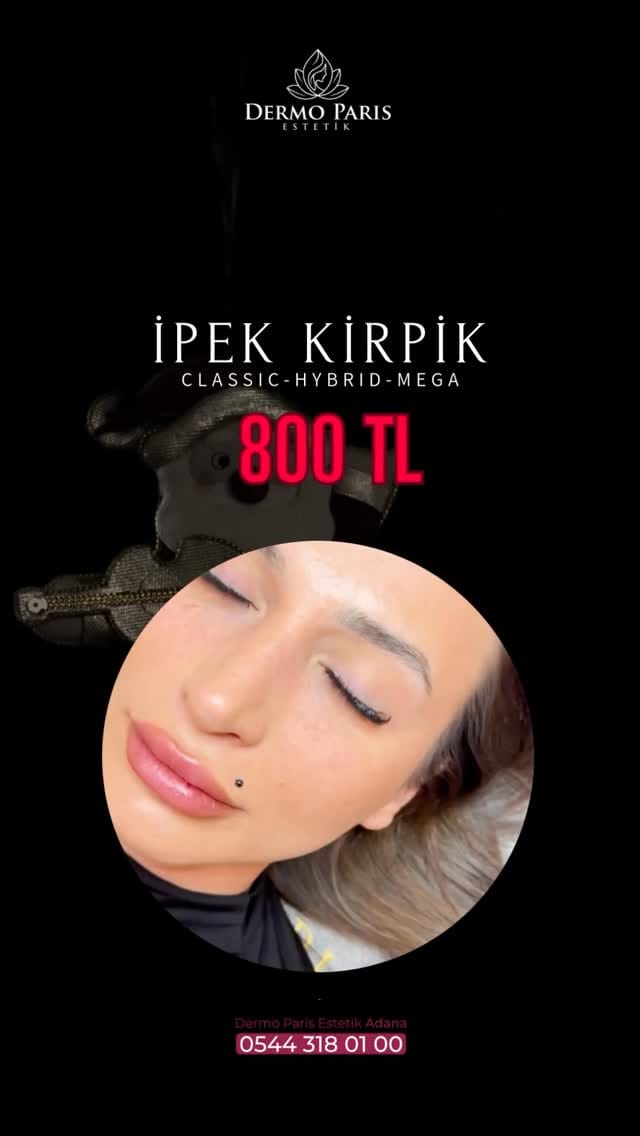 Post 1 by Dermo Paris Estetik on Instagram (video)