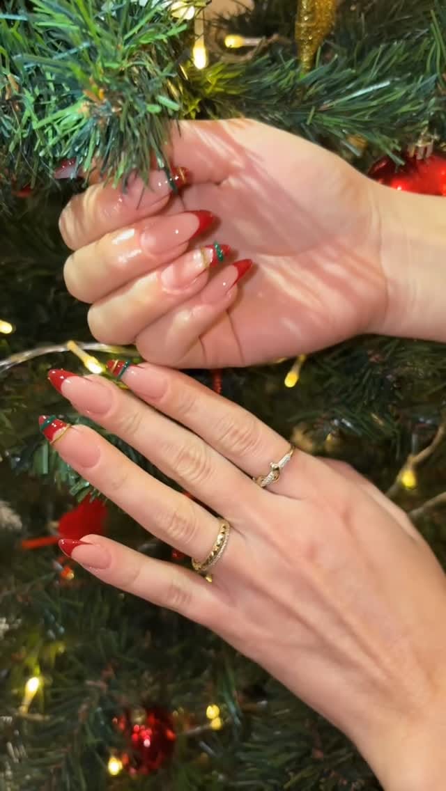 Post 3 by Dermo Paris Estetik on Instagram (video)