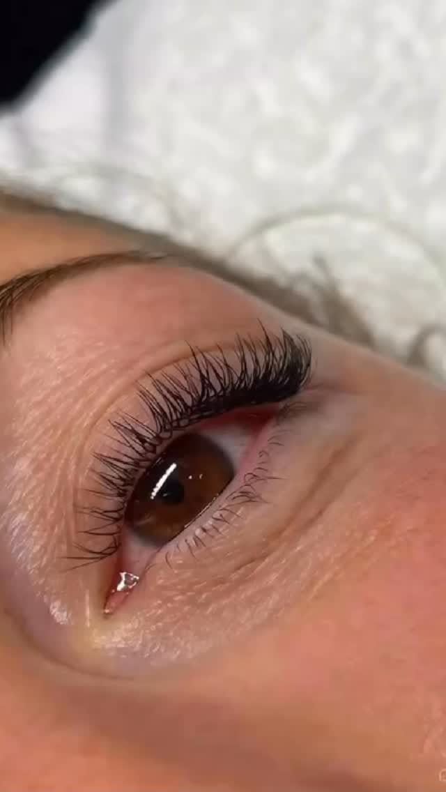 Post 4 by Dermo Paris Estetik on Instagram (video)