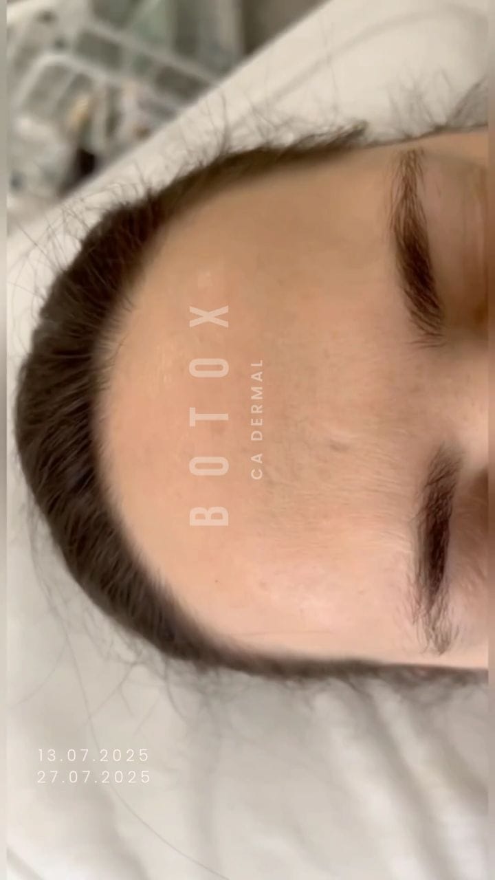 Post 1 by CA Dermal on Instagram (video)