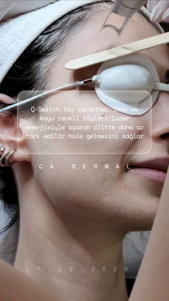Post 10 by CA Dermal on Instagram (video)