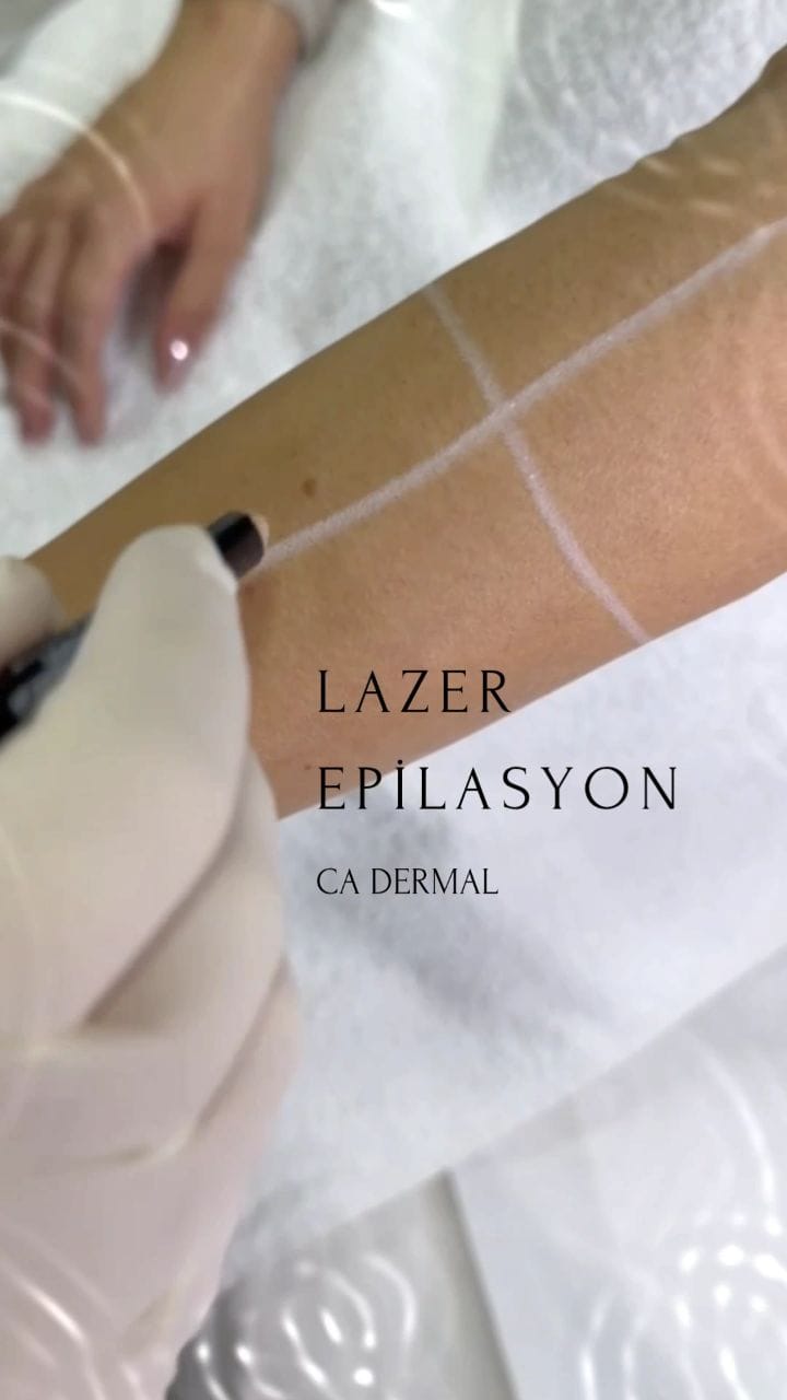Post 6 by CA Dermal on Instagram (video)