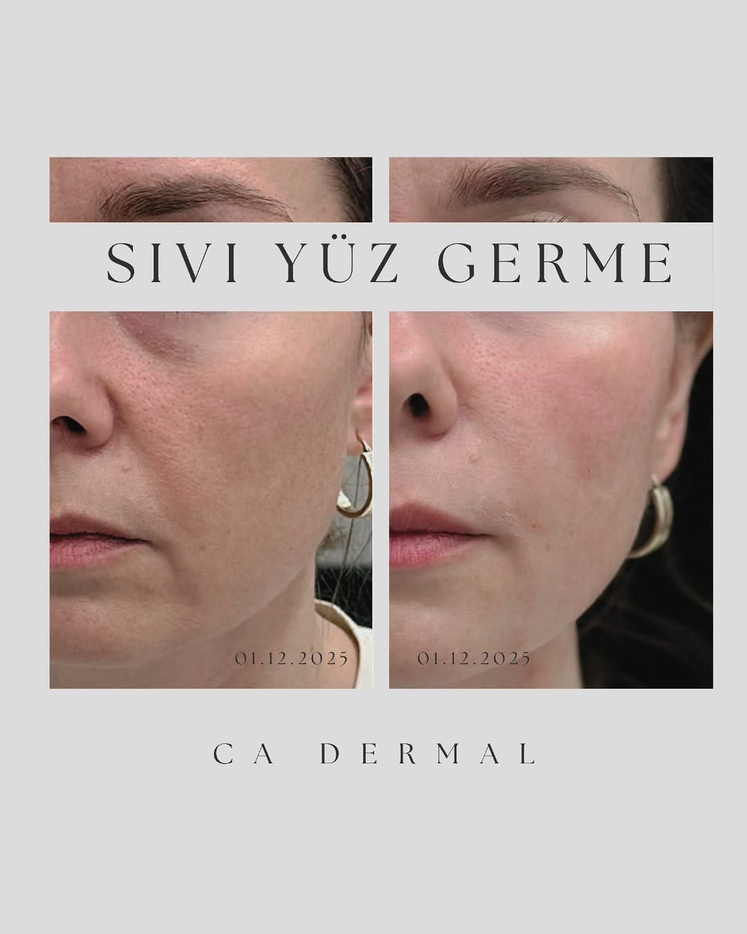 Post 8 by CA Dermal on Instagram (image)