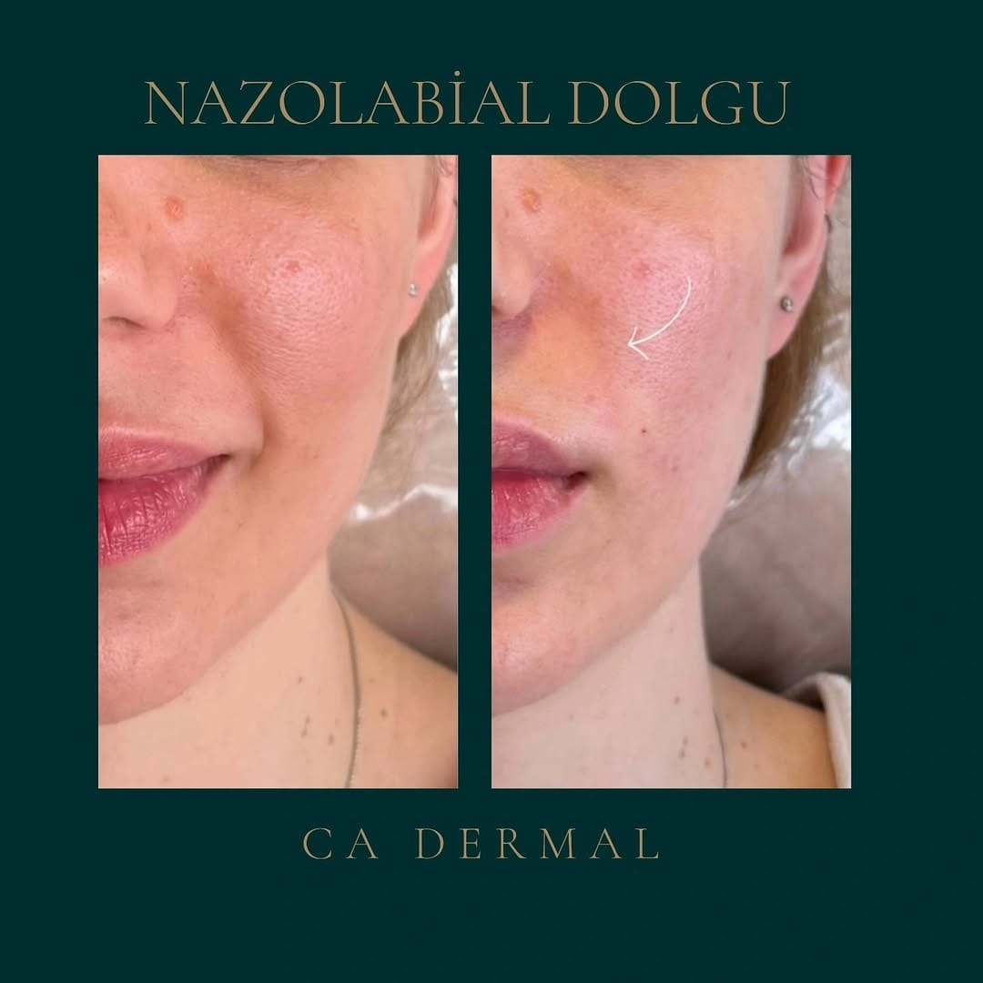 Post 3 by CA Dermal on Instagram (image)