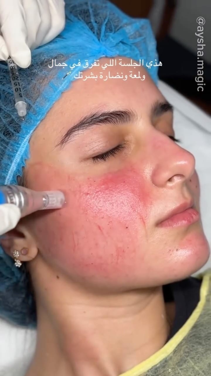 Post 6 by Salon Aysha Magic | صالون عائشه ماجيك on Instagram (video)