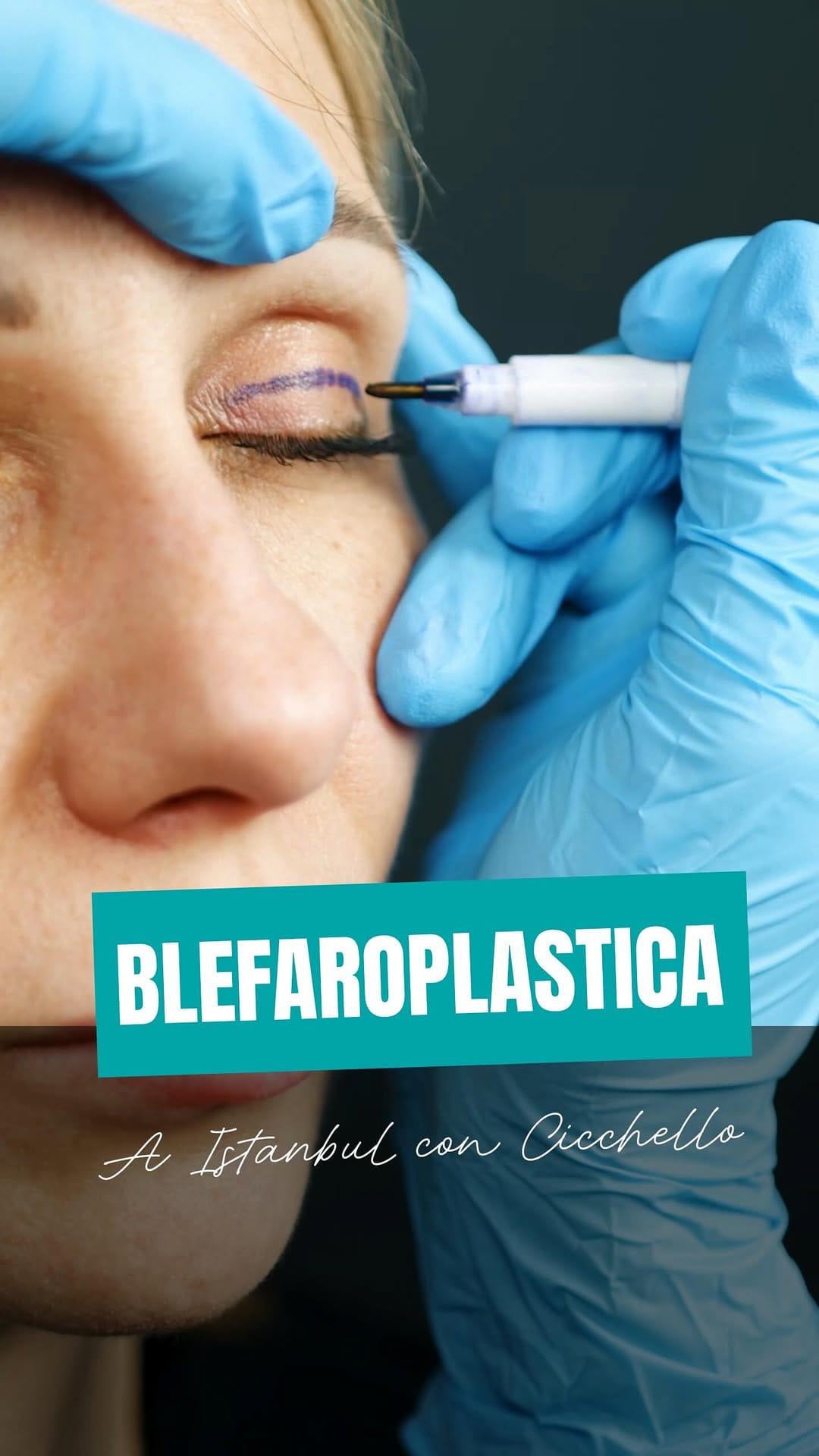 Post 2 by Cicchello_Chirurgia_ Estetica e dentale on Instagram (video)