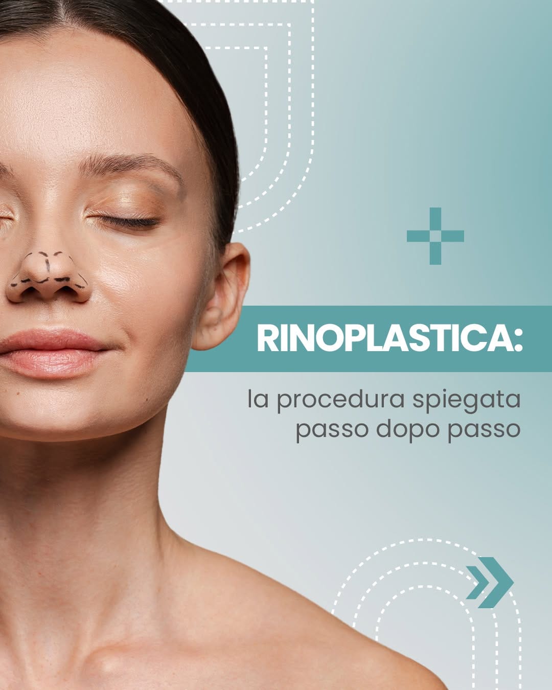 Post 7 by Cicchello_Chirurgia_ Estetica e dentale on Instagram (carousel)