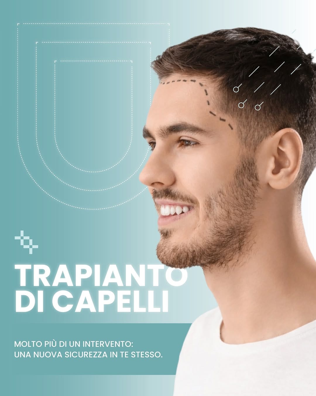 Post 1 by Cicchello_Chirurgia_ Estetica e dentale on Instagram (image)