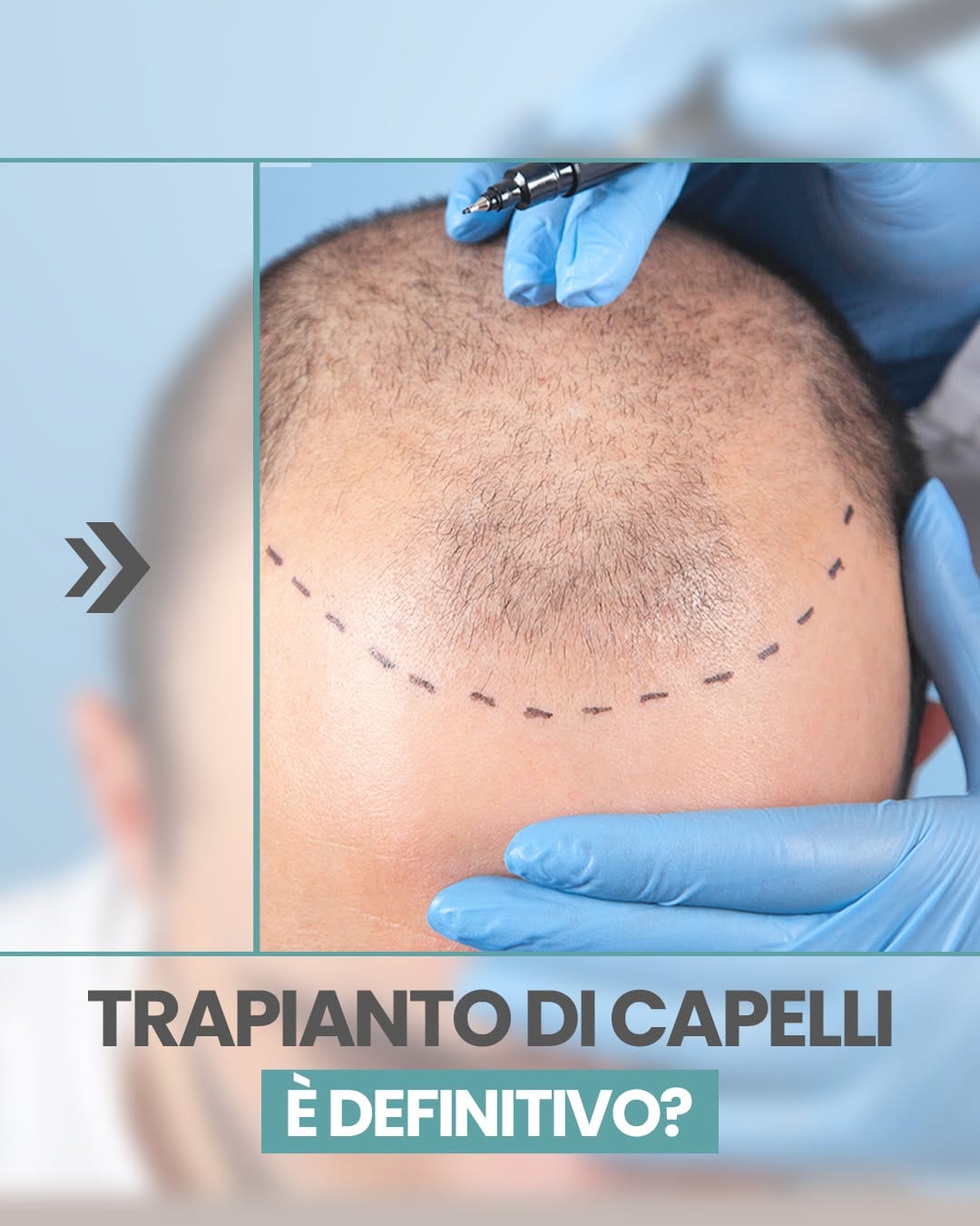 Post 9 by Cicchello_Chirurgia_ Estetica e dentale on Instagram (carousel)