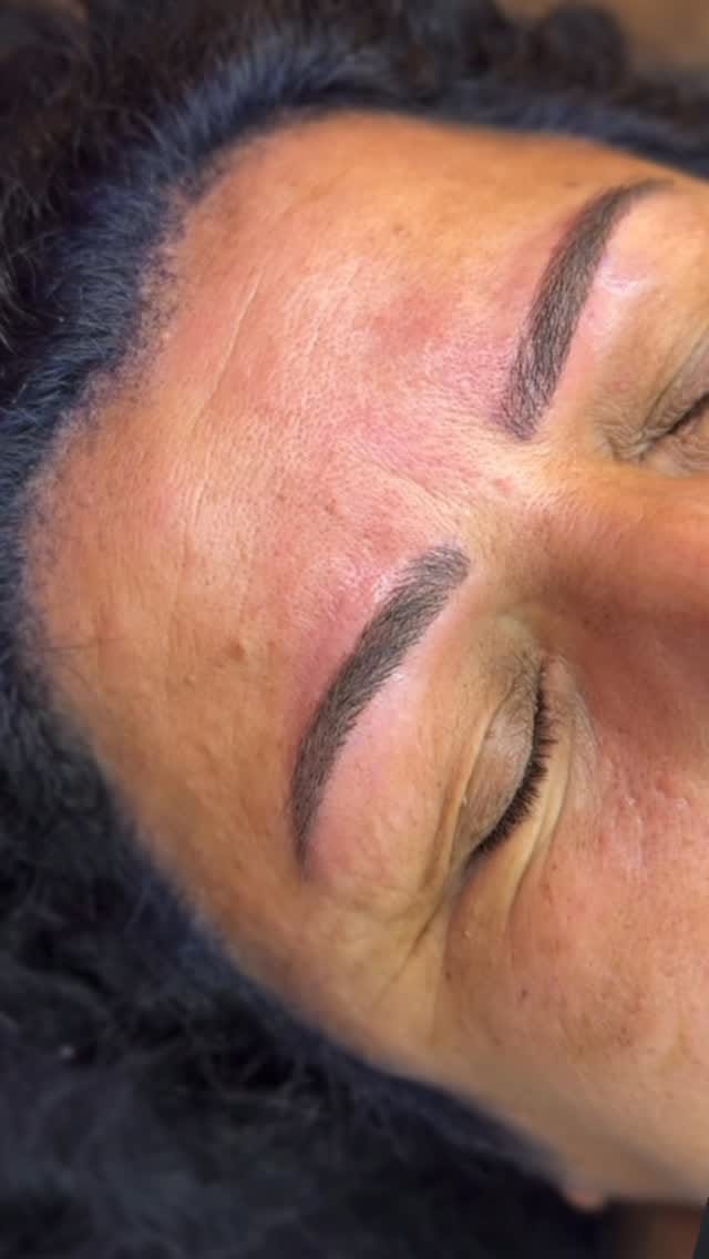 Post 7 by Uzm. Estetisyen Ayşenur Aratoğlu on Instagram (video)