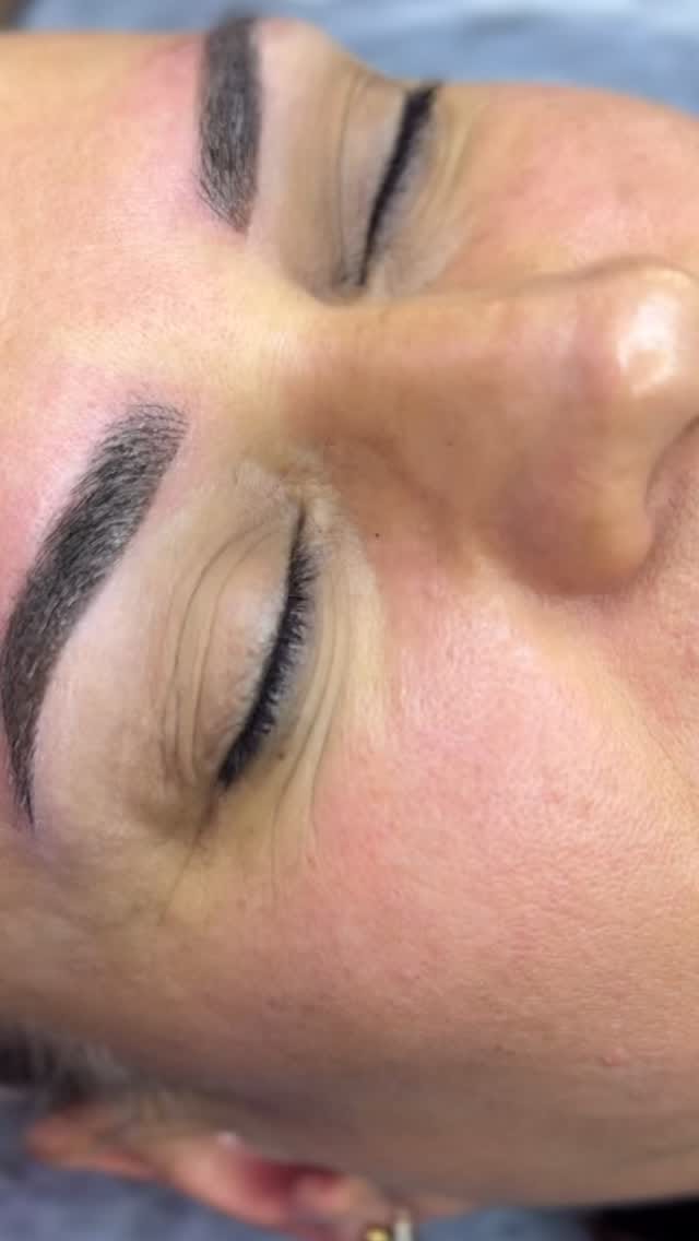 Post 8 by Uzm. Estetisyen Ayşenur Aratoğlu on Instagram (video)