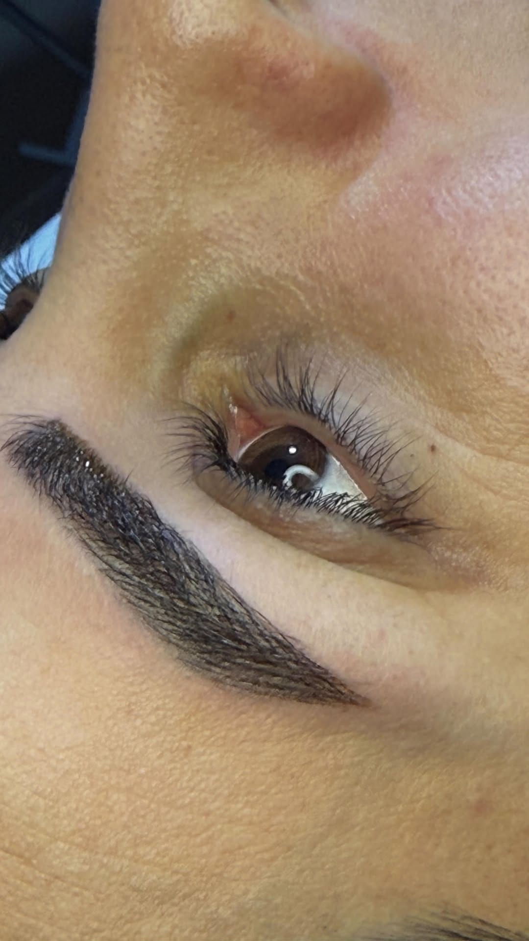 Post 9 by LİMA ESTETİK on Instagram (video)