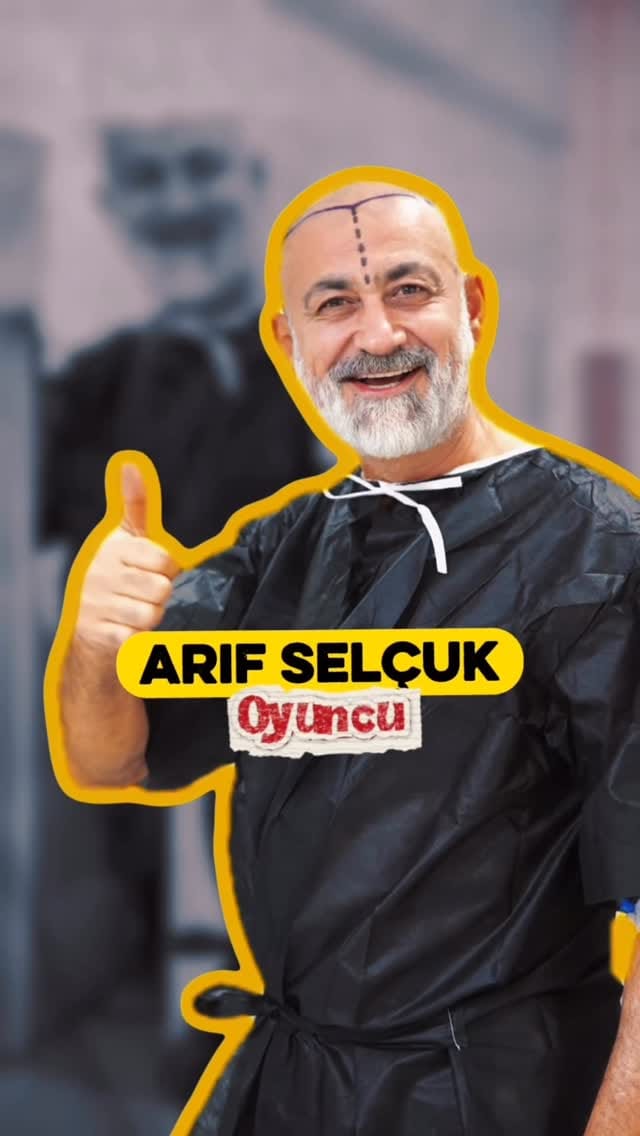 Post 5 by Serkan Aydın Saç Ekimi - Hair Transplant on Instagram (video)