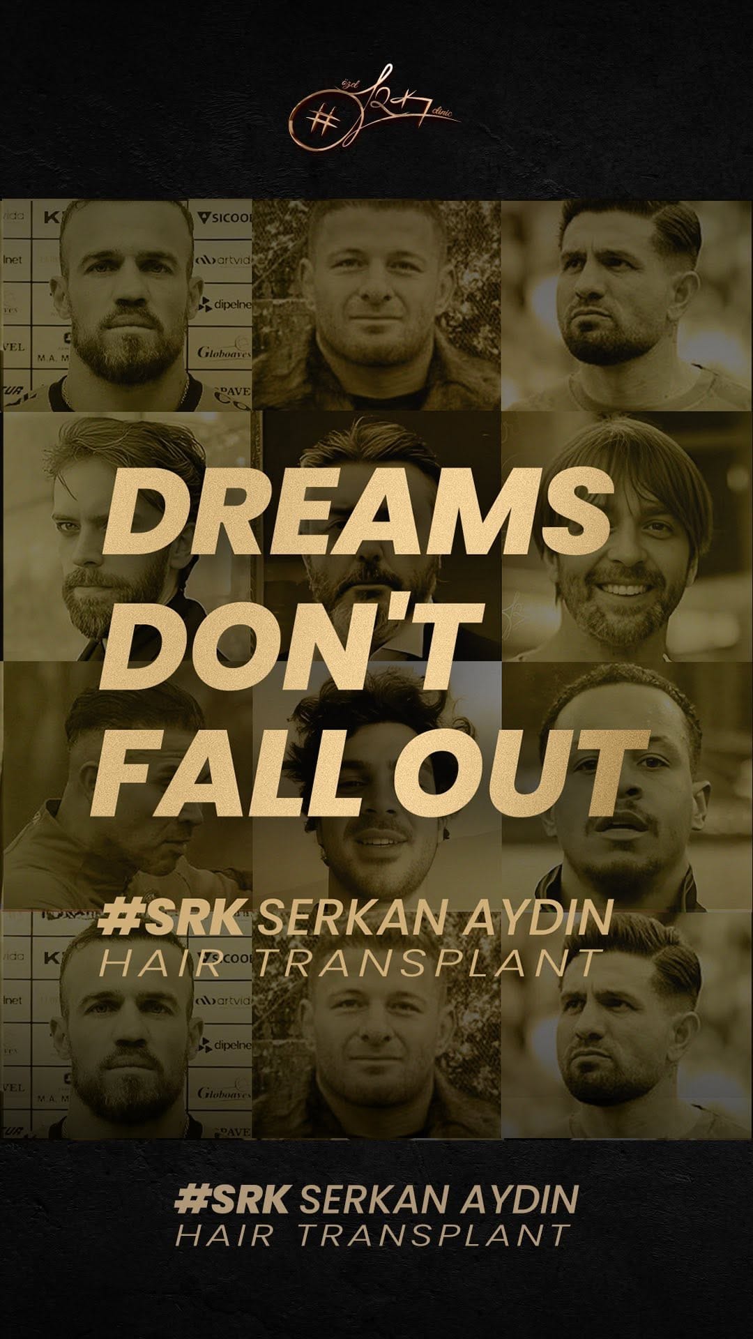 Post 8 by Serkan Aydın Saç Ekimi - Hair Transplant on Instagram (video)