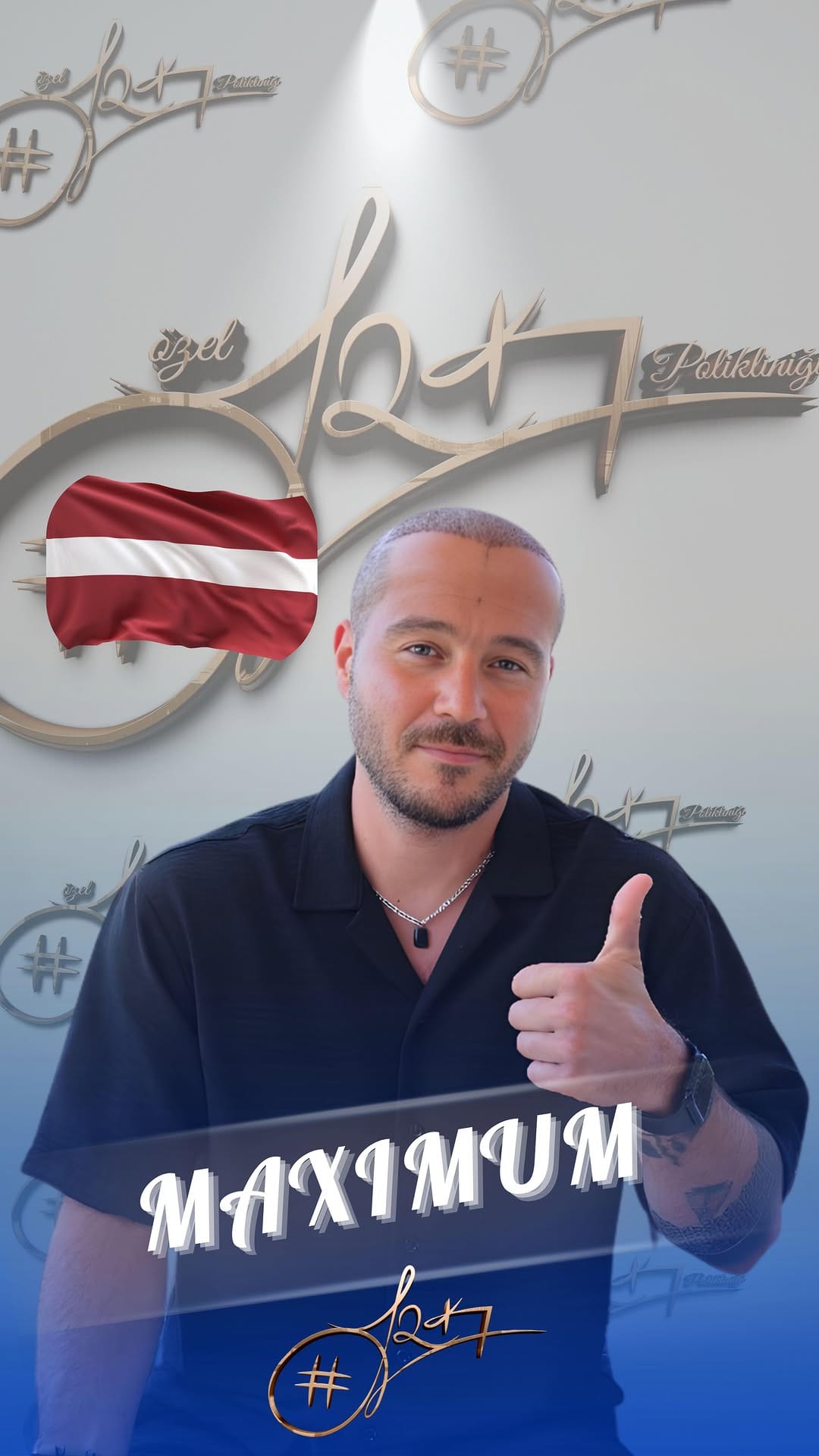Post 7 by Serkan Aydın Saç Ekimi - Hair Transplant on Instagram (video)