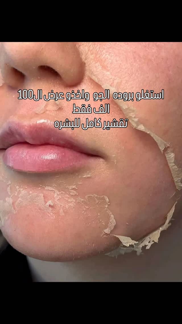 Post 5 by Dr.RAFAL  rofa  AL-HILFI on Instagram (video)