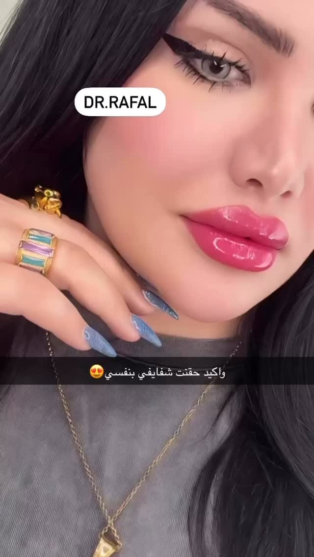 Post 6 by Dr.RAFAL  rofa  AL-HILFI on Instagram (video)