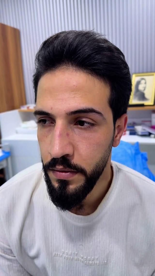 Post 10 by Dr.RAFAL  rofa  AL-HILFI on Instagram (video)