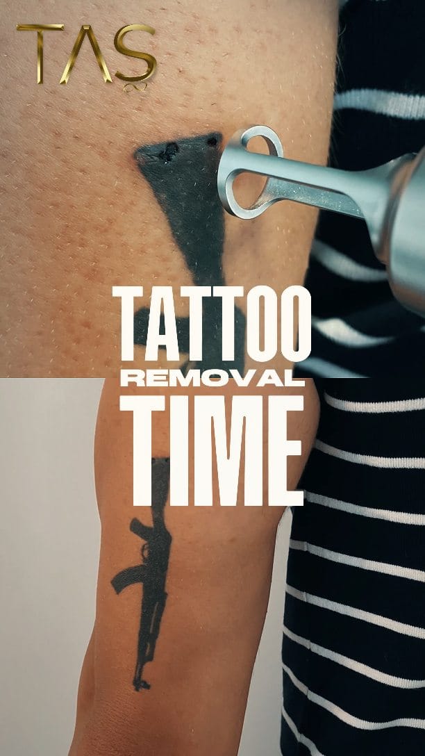 Post 7 by TAŞ Klinik on Instagram (video)