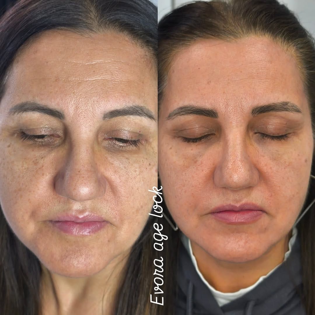 Post 1 by Sakarya Güzellik Salonu İpek Beauty on Instagram (carousel)