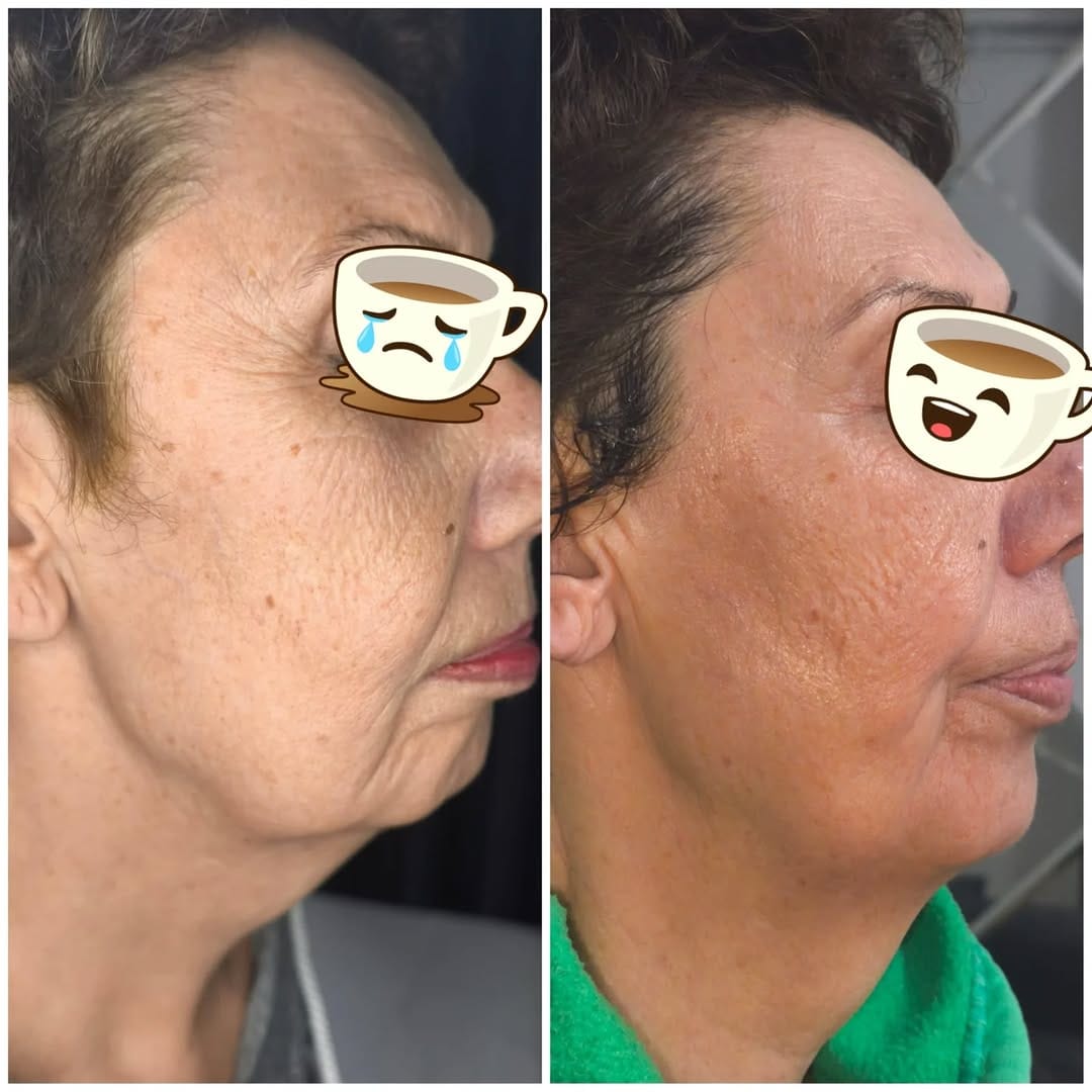 Post 2 by Sakarya Güzellik Salonu İpek Beauty on Instagram (carousel)