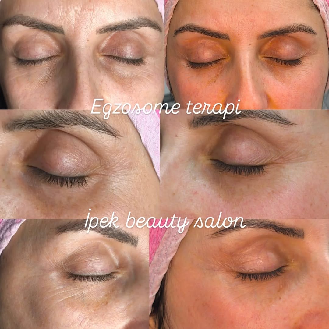 Post 4 by Sakarya Güzellik Salonu İpek Beauty on Instagram (image)