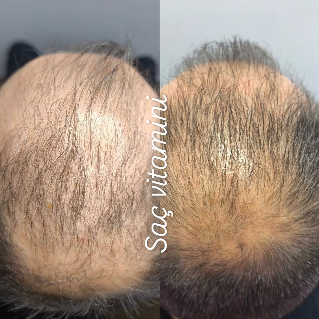 Post 5 by Sakarya Güzellik Salonu İpek Beauty on Instagram (image)