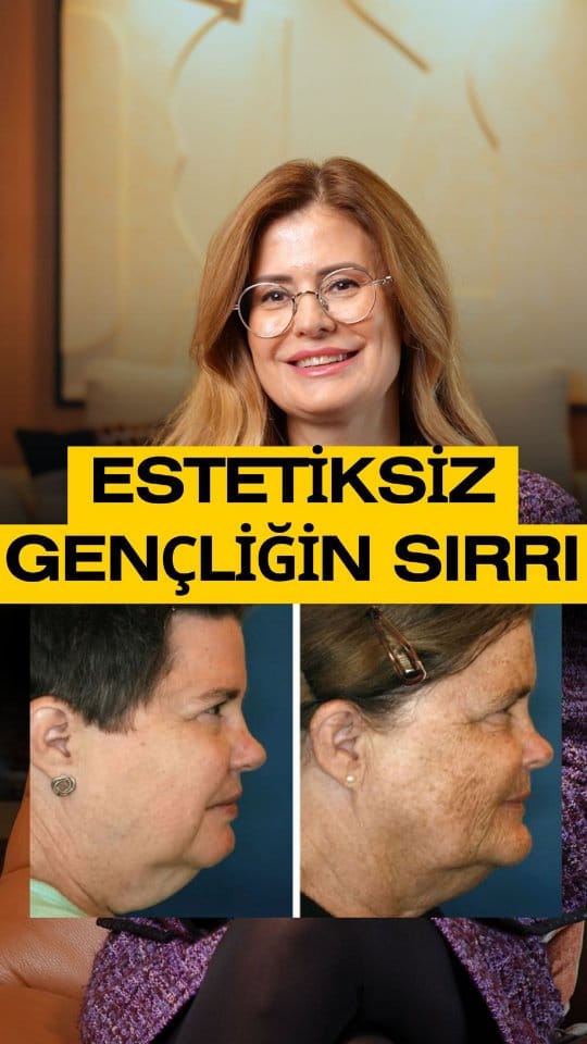 Post 5 by Esra Zengin on Instagram (video)
