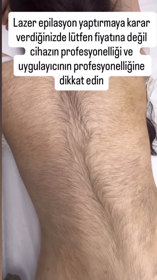Post 6 by Tülay Tezel |  Lin Güzellik on Instagram (video)