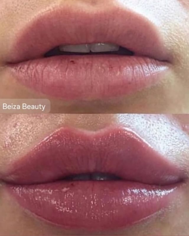 Post 2 by Beiza Beauty on Instagram (image)
