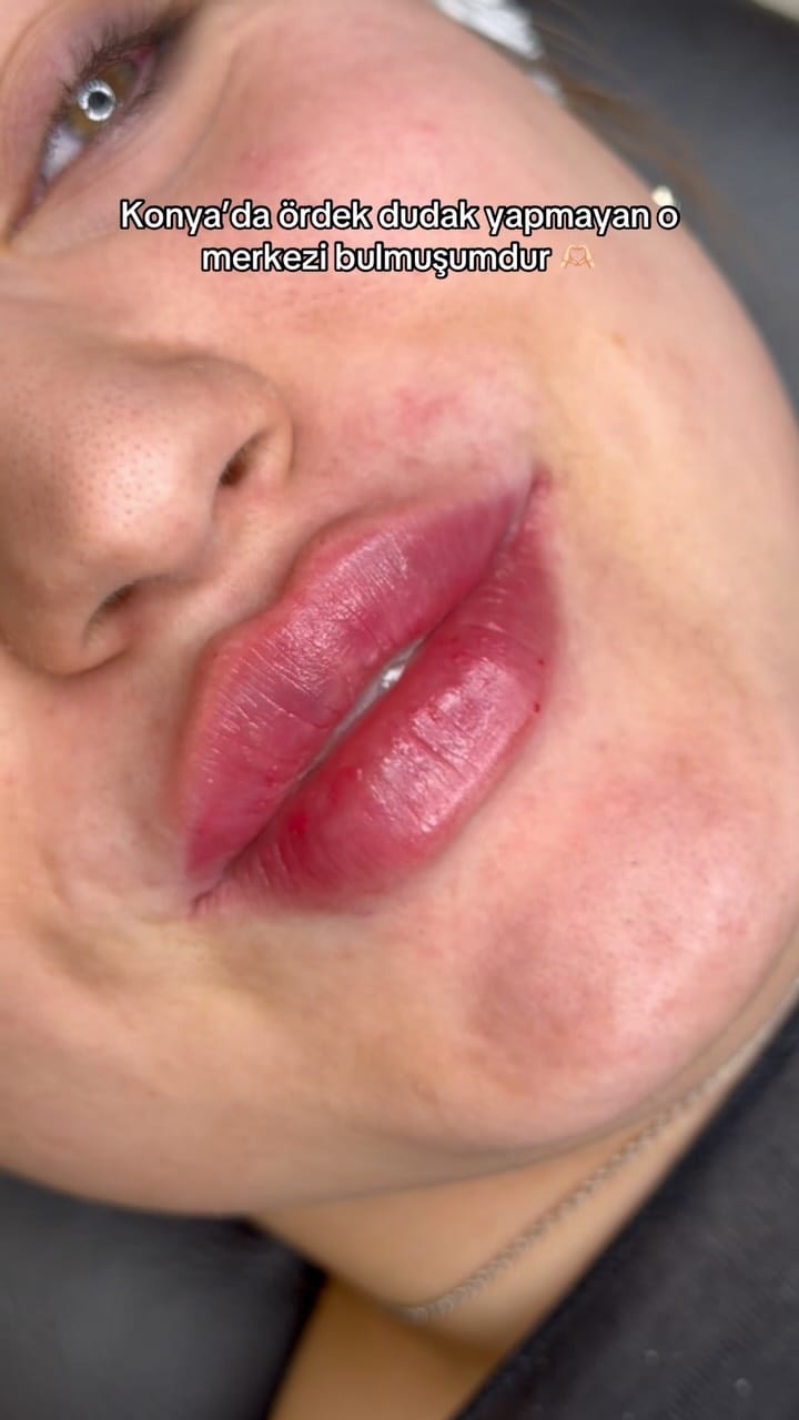 Post 1 by Beiza Beauty on Instagram (video)