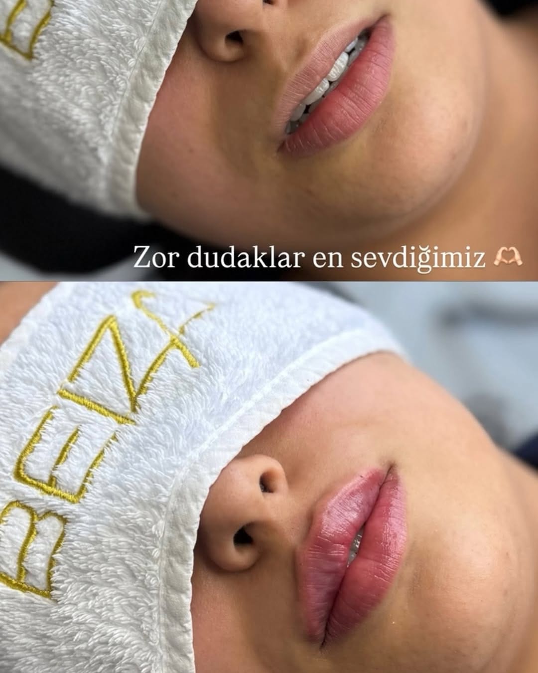 Post 3 by Beiza Beauty on Instagram (image)