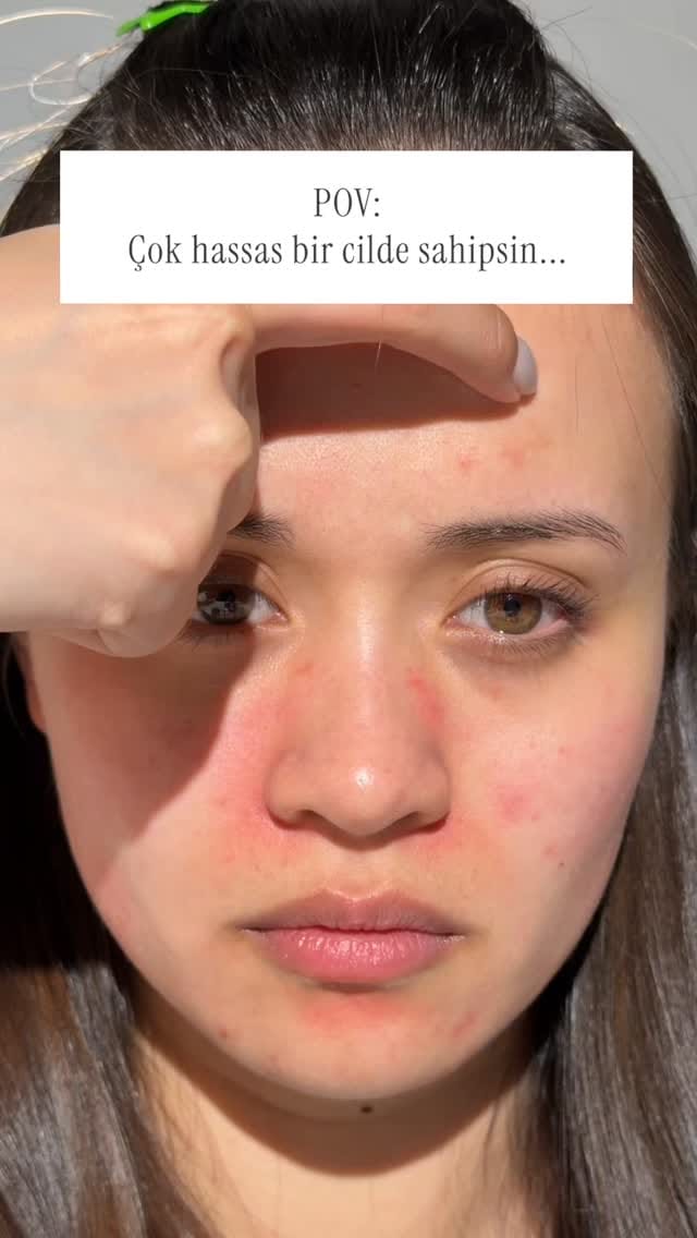 Post 1 by KORENDY.COM.TR - Kore Kozmetik on Instagram (video)
