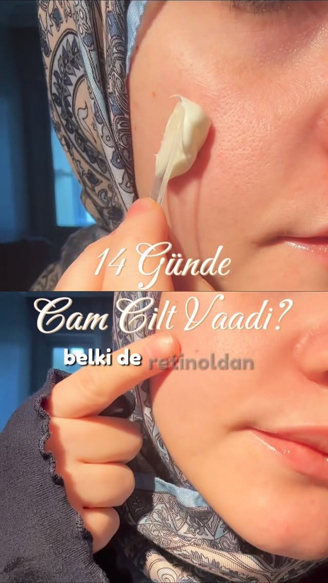 Post 6 by KORENDY.COM.TR - Kore Kozmetik on Instagram (video)