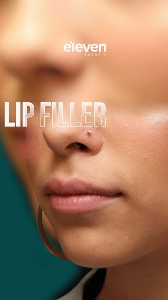 Post 6 by Cosmetic Surgery on Instagram (video)