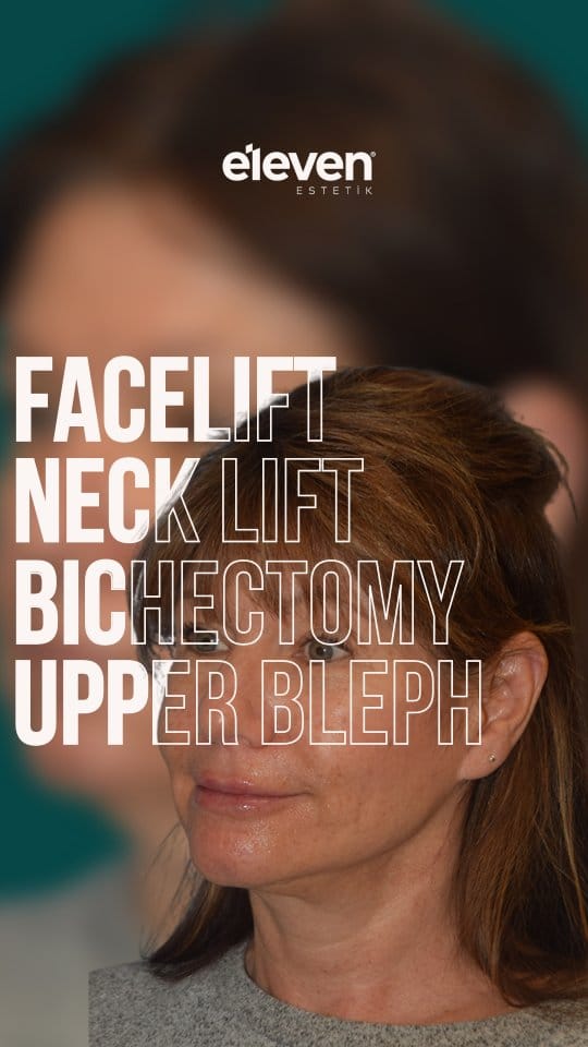 Post 7 by Cosmetic Surgery on Instagram (video)