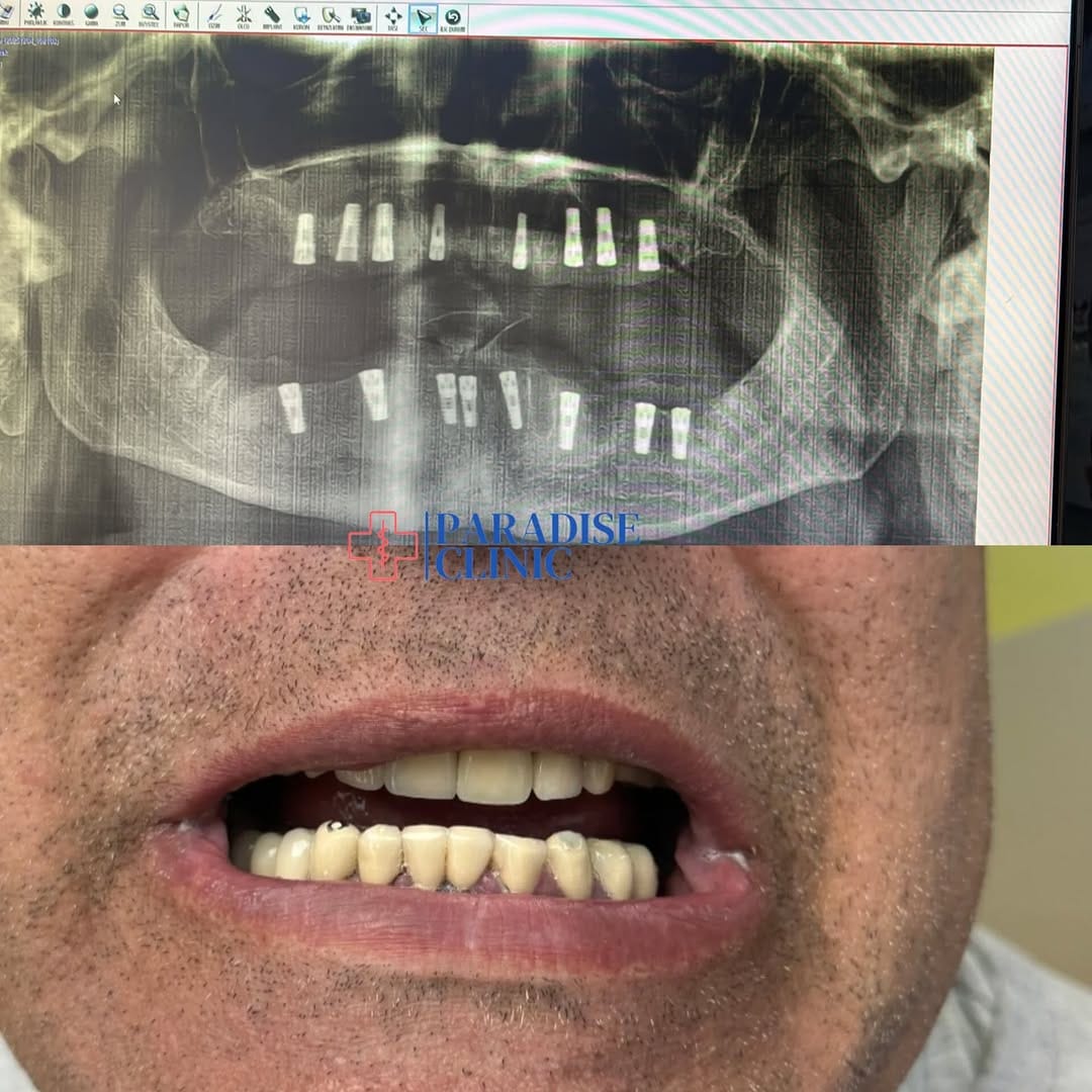 Post 7 by PARADISE CLINIC on Instagram (image)