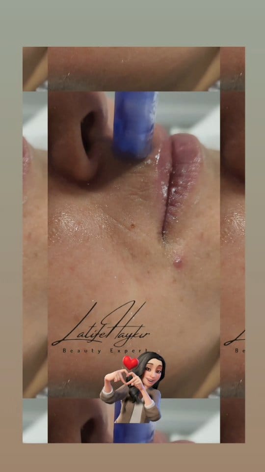 Post 1 by Begüm Şahpaz on Instagram (video)