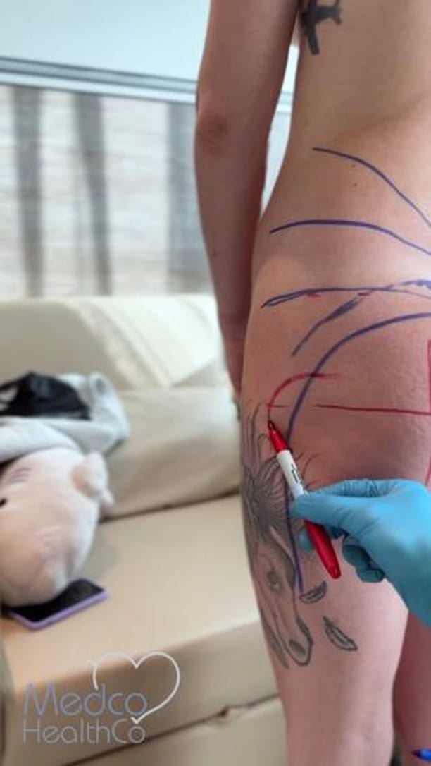 Post 6 by Medco Healthco on Instagram (video)