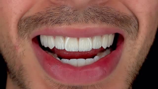 Post 4 by Sunny Dent on Instagram (video)