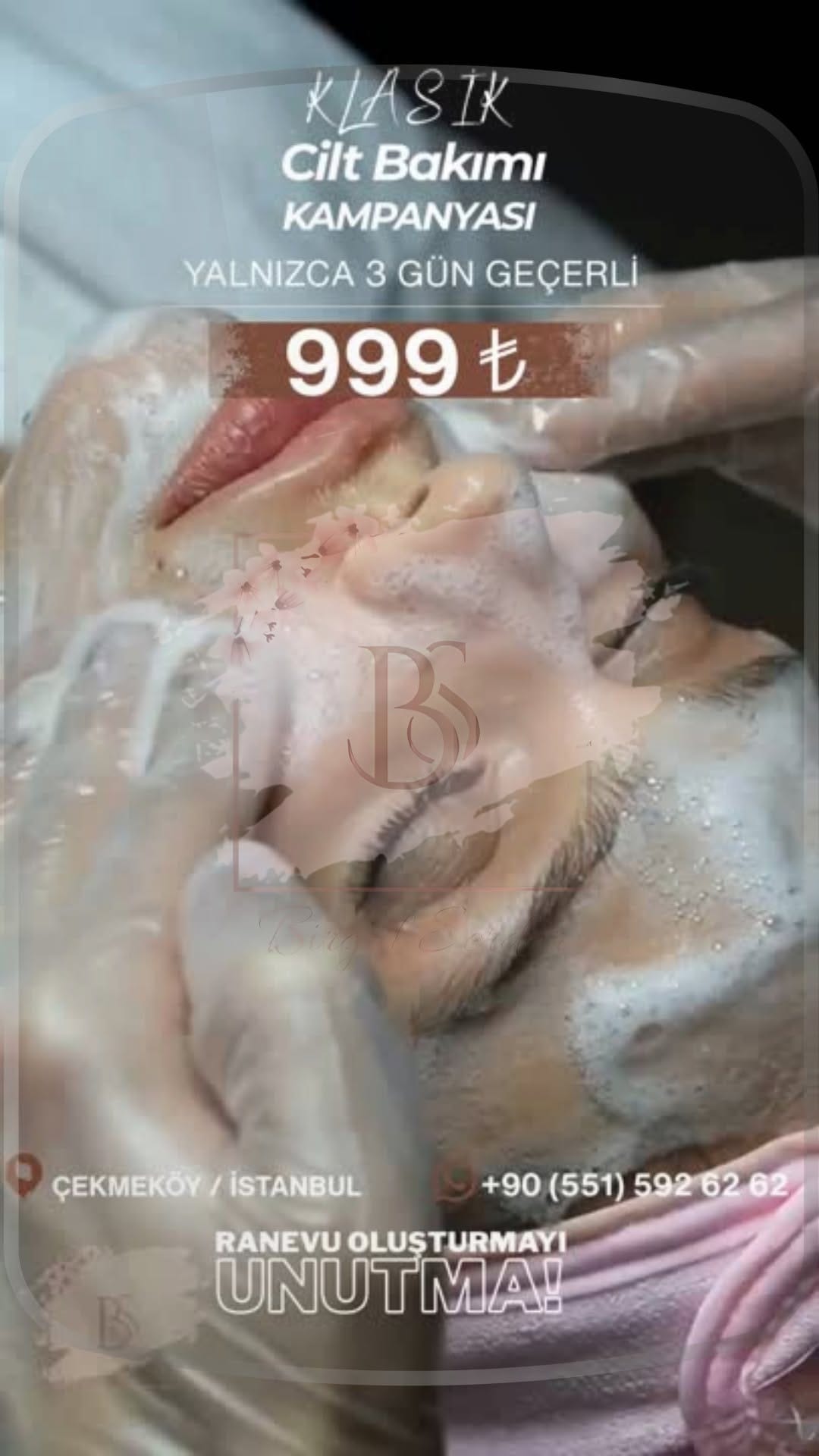 Post 8 by ÇEKMEKÖY | PROTEZ TIRNAK / BÖLGESEL İNCELME / LAZER EPİLASYON on Instagram (video)